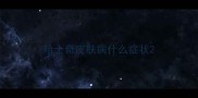 哈士奇皮肤病什么症状