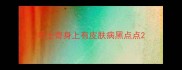 哈士奇身上有皮肤病黑点点