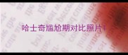 哈士奇尴尬期对比照片