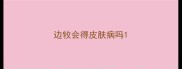 边牧会得皮肤病吗